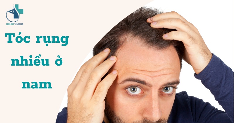 Rụng tóc nhiều ở nam: Nguyên nhân, dấu hiệu và cách điều trị