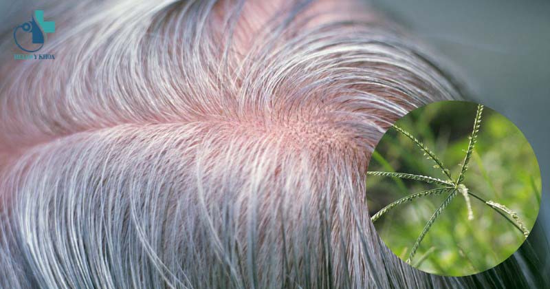 Cách dùng cỏ mần trầu trị bạc tóc sớm