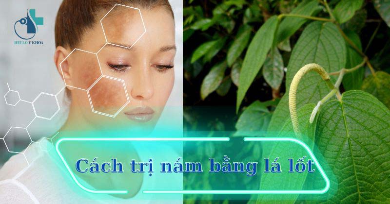 Cách trị nám bằng lá lốt