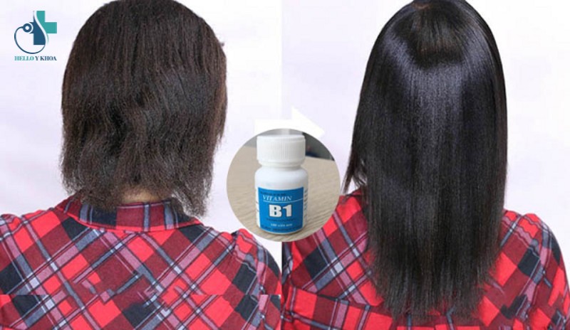 Một số câu hỏi thường gặp khi dùng vitamin B1 mọc tóc