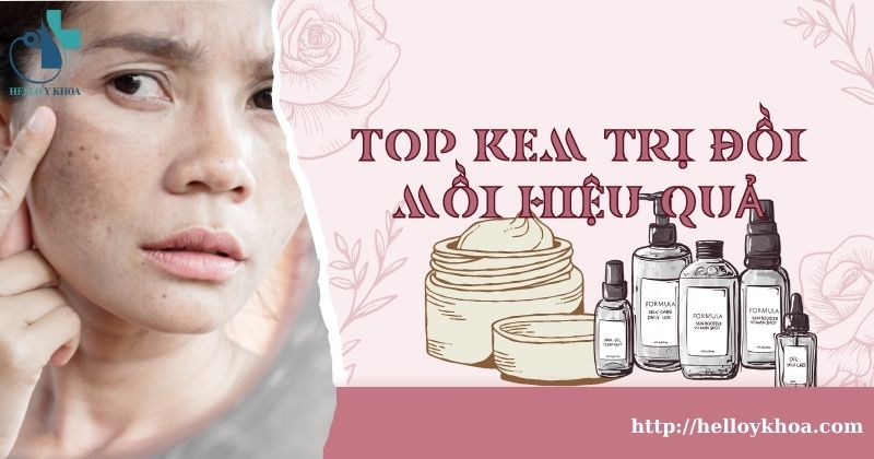 Top kem trị đồi mồi hiệu quả