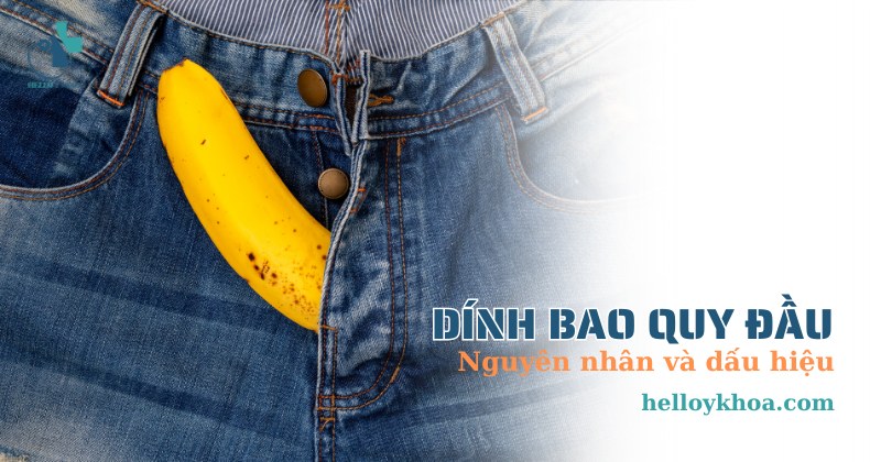 dính bao quy đầu