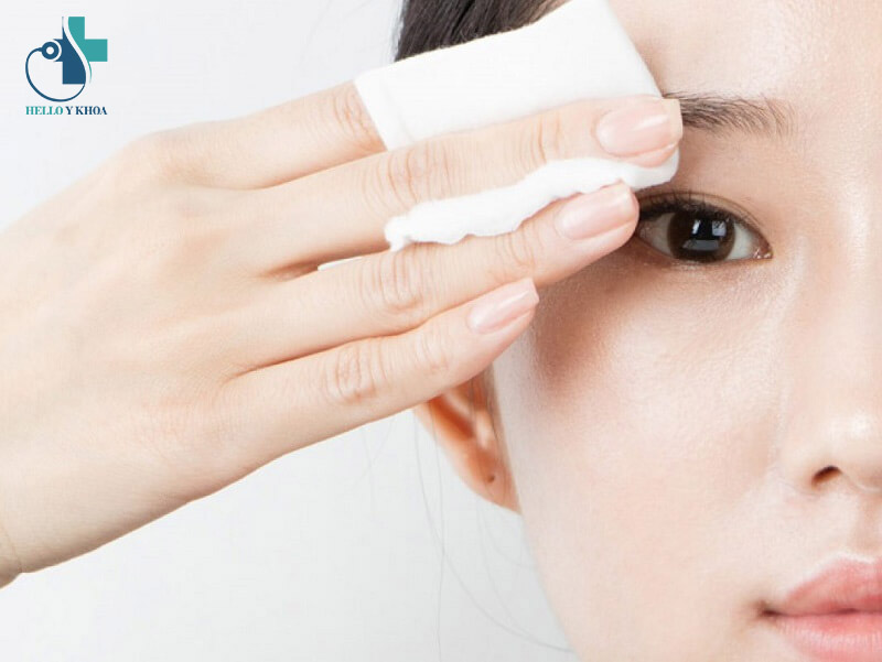 Cần vệ sinh mắt đúng cách sau khi phẫu thuật lấy mỡ bọng mắt