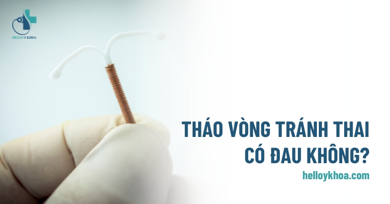 tháo vòng tránh thai có đau không