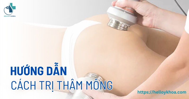 Hướng dẫn cách trị thâm mông hiệu quả