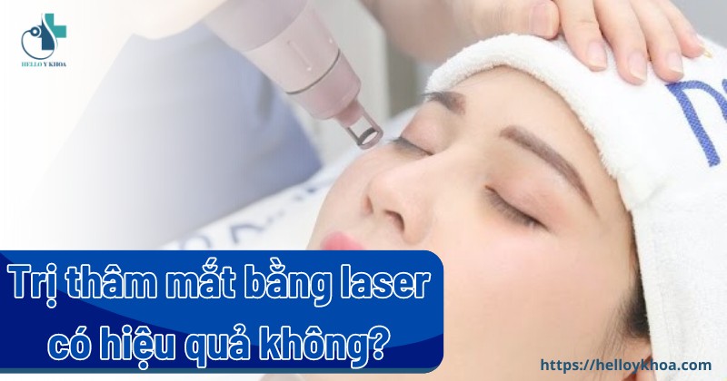 Cách trị thâm mắt bằng laser